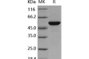 Western Blotting (WB) image for C-Mer Proto-Oncogene Tyrosine Kinase (MERTK) protein (GST tag,His tag) (ABIN7317111)