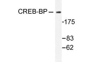 Image no. 1 for anti-CREB Binding Protein (CREBBP) antibody (ABIN265372) (CBP anticorps)