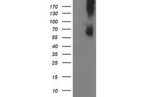 Western Blotting (WB) image for anti-phosphodiesterase 1B, Calmodulin-Dependent (PDE1B) antibody (ABIN1500075) (PDE1B anticorps)