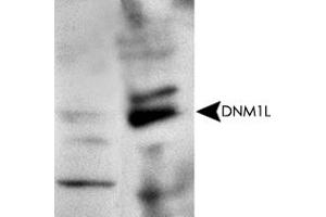 Western blot analysis with DNM1L polyclonal antibody  at 1 : 500x dilution. (Dynamin 1-Like anticorps  (AA 500-600))