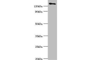 Western blot All lanes: USP8 antibody at 14 μg/mL + 293T whole cell lysate Secondary Goat polyclonal to rabbit IgG at 1/10000 dilution Predicted band size: 128, 116 kDa Observed band size: 128 kDa (USP8 anticorps  (C-Term))