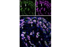 Multiplex staining of TRPM8 and TrkA in rat DRG - Immunohistochemical staining of perfusion-fixed frozen rat dorsal root ganglia (DRG) sections using Anti-TrkA (extracellular)-ATTO Fluor-633 Antibody (ABIN7043386), (1:60) and Anti-TRPM8 (extracellular) Antibody (ABIN7043837, ABIN7044016 and ABIN7044017), (1:300).