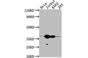 Western Blot Positive WB detected in: Hela whole cell lysate, Jurkat whole cell lysate, K562 whole cell lysate, 293 whole cell lysate All lanes: CDK6 antibody at 1:2000 Secondary Goat polyclonal to rabbit IgG at 1/50000 dilution Predicted band size: 37 kDa Observed band size: 37 kDa (Recombinant CDK6 anticorps)