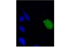 Immunofluorescence (IF) image for anti-Human Papilloma Virus 18 E7 (HPV-18 E7) (AA 1-35), (N-Term) antibody (ABIN781779) (HPV18 E7 anticorps  (N-Term))