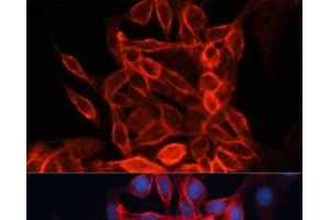 Immunofluorescence analysis of HeLa cells using CD98 Polyclonal Antibody at dilution of 1:100 (40x lens).