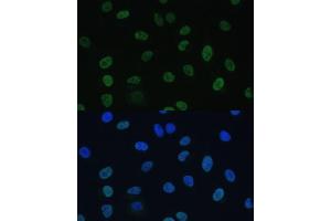 Immunofluorescence analysis of U-2 OS cells using GTF2E1 Polyclonal Antibody (ABIN7267371) at dilution of 1:100 (40x lens).