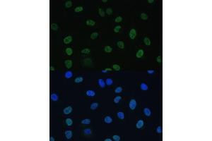 Immunofluorescence analysis of U-2 OS cells using GTF2E1 Polyclonal Antibody (ABIN7267371) at dilution of 1:100 (40x lens). (GTF2E1 anticorps  (AA 230-439))