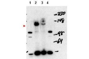 Western blot using  affinity purified anti-NCOA3 antibody shows detection of NCOA3 in mouse liver nuclear extract (lane 1), transient transfected 293 cell lysate (lane 2), HeLa whole cell lysate (lane 3) and mouse thyroid cell nuclear extract (lane 4). (NCOA3 anticorps)