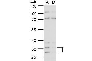 WB Image Histamine H4 Receptor antibody detects Histamine H4 Receptor protein by western blot analysis.