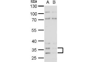 WB Image Histamine H4 Receptor antibody detects Histamine H4 Receptor protein by western blot analysis. (HRH4 anticorps  (N-Term))