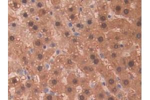 Detection of SDH in Rat Liver Tissue using Polyclonal Antibody to Sorbitol Dehydrogenase (SDH)
