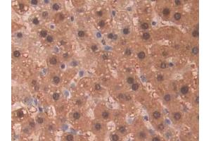 Detection of SDH in Rat Liver Tissue using Polyclonal Antibody to Sorbitol Dehydrogenase (SDH) (SORD anticorps  (AA 2-357))
