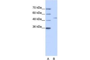 Western Blotting (WB) image for anti-Zinc Finger Protein 555 (ZNF555) antibody (ABIN2461313) (ZNF555 anticorps)