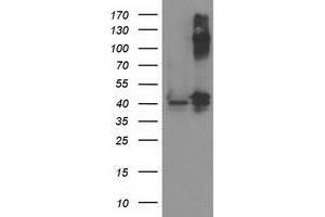 Image no. 2 for anti-Pantothenate Kinase 3 (PANK3) antibody (ABIN1500028) (PANK3 anticorps)