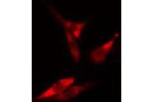 ABIN6266692 staining HeLa cells by IF/ICC. (RANKL anticorps  (Internal Region))