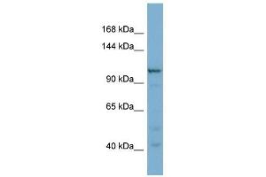 COPG2 antibody used at 1 ug/ml to detect target protein. (COPG2 anticorps  (N-Term))