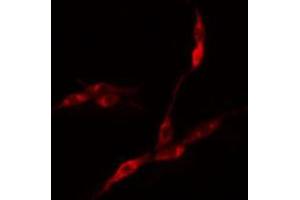 ABIN6275121 staining COLO205 cells by IF/ICC. (EIF3F anticorps  (Internal Region))