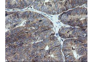 Image no. 7 for anti-Ubiquitin-Conjugating Enzyme E2G 2 (UBE2G2) antibody (ABIN1501630)