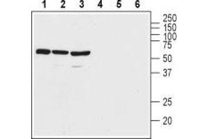 Western blot analysis of rat brain lysate (lanes 1 and 4), mouse brain lysate (lanes 2 and 5), and human Malme-3M melanoma cell lysate (lanes 3 and 6): - 1-3. (VIPR2 anticorps  (Extracellular, N-Term))