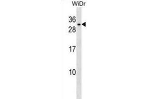 Western Blotting (WB) image for anti-Basic Helix-Loop-Helix Family, Member A9 (BHLHA9) antibody (ABIN3000475)