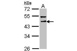 WB Image Sample (30 ug of whole cell lysate) A: A431 , 10% SDS PAGE antibody diluted at 1:1000 (DLST anticorps  (Center))