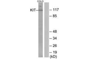 Western blot analysis of extracts from COLO205 cells, using KIT (Ab-936) Antibody. (KIT anticorps  (AA 906-955))