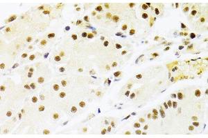 Immunohistochemistry of paraffin-embedded Human stomach using RBPJ Polyclonal Antibody at dilution of 1:100 (40x lens). (RBPJ anticorps)
