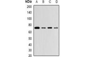Western blot analysis of ZNF145 expression in Hela (A), THP1 (B), mouse lung (C), mouse brain (D) whole cell lysates. (ZBTB16 anticorps)