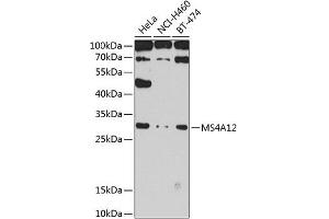 Western blot analysis of extracts of various cell lines, using MS4 antibody (ABIN6131373, ABIN6144052, ABIN6144053 and ABIN6224244) at 1:1000 dilution. (MS4A12 anticorps  (AA 1-90))
