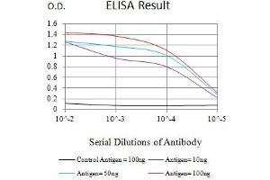 Black line: Control Antigen (100 ng),Purple line: Antigen (10 ng), Blue line: Antigen (50 ng), Red line:Antigen (100 ng)