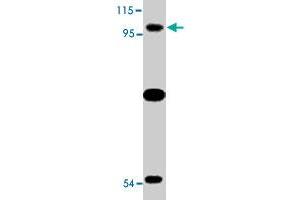Western blot analysis of TLR6 expression in Jurkat cell lysate with TLR6 polyclonal antibody  at 2 ug/mL . (TLR6 anticorps  (N-Term))