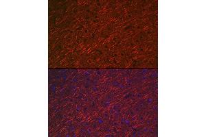 Immunofluorescence analysis of rat brain cells using M Rabbit pAb (ABIN3016264, ABIN3016265, ABIN3016266, ABIN1680752 and ABIN6219676) at dilution of 1:100 (40x lens).