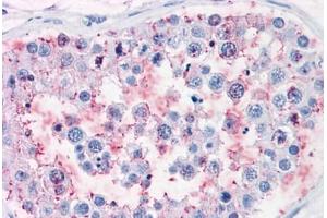 Human Testis: Formalin-Fixed, Paraffin-Embedded (FFPE) (ENPP3 anticorps  (Internal Region))