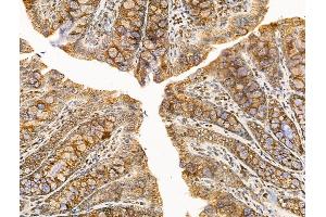 ABIN7094741 and ABIN7098792 at 1/100 staining Rat colorectal tissue by IHC-P. (DBT anticorps  (C-Term))