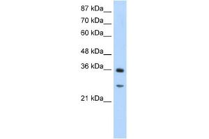 WB Suggested Anti-GIPC2 Antibody Titration:  1. (GIPC2 anticorps  (N-Term))