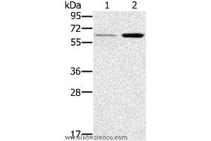 Western blot analysis of Human liver and mouse kidney tissue, using TNFRSF11A Polyclonal Antibody at dilution of 1:200 (TNFRSF11A anticorps)