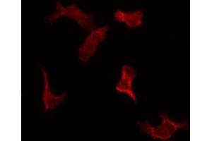 ABIN6269240 staining LOVO by IF/ICC.