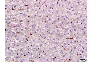 Formalin-fixed and paraffin embedded rat liver labeled with Rabbit Anti LIF Polyclonal Antibody, Unconjugated (ABIN737046) at 1:200 followed by conjugation to the secondary antibody and DAB staining