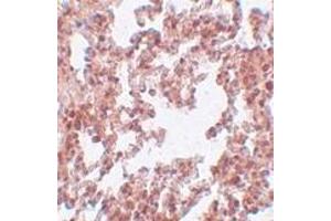 Immunohistochemistry of PLEKHM3 in human brain tissue with AP30330PU-N PLEKHM3 antibody at 5 μg/ml. (FAM59A anticorps  (C-Term))