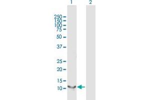 Western Blot analysis of RBP5 expression in transfected 293T cell line by RBP5 MaxPab polyclonal antibody. (Retinol Binding Protein 5 anticorps  (AA 1-135))