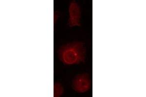 ABIN6267023 staining HuvEc by IF/ICC. (Nibrin anticorps  (pSer278))