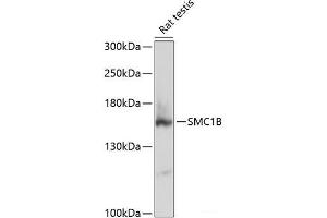 Western blot analysis of extracts of Rat testis using SMC1B Polyclonal Antibody at dilution of 1:3000. (SMC1B anticorps)