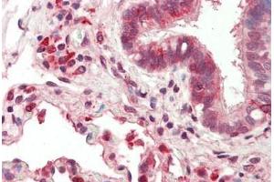 Human, Lung: Formalin-Fixed Paraffin-Embedded (FFPE)