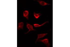 ABIN6267279 staining Hela by IF/ICC. (RAF1 anticorps  (pSer621))