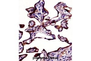 Immunohistochemistry (IHC) image for anti-Placental Alkaline Phosphatase (ALPP) antibody (ABIN2998362) (PLAP anticorps)