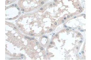 IHC-P analysis of Human Kidney Tissue, with DAB staining. (COQ6 anticorps  (AA 1-468))
