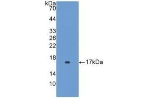 Detection of Recombinant IL1F9, Mouse using Polyclonal Antibody to Interleukin 1 Family, Member 9 (IL1F9) (IL1F9 anticorps  (AA 5-149))