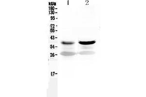 Western blot analysis of MEK6 using anti-MEK6 antibody . (MAP2K6 anticorps  (AA 280-334))
