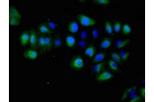 Immunofluorescent analysis of A549 cells using ABIN7151843 at dilution of 1:100 and Alexa Fluor 488-congugated AffiniPure Goat Anti-Rabbit IgG(H+L)