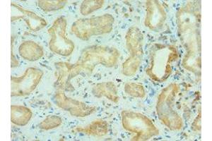 Immunohistochemistry of paraffin-embedded human kidney tissue using ABIN7145825 at dilution of 1:100 (BRD9 anticorps  (AA 338-597))